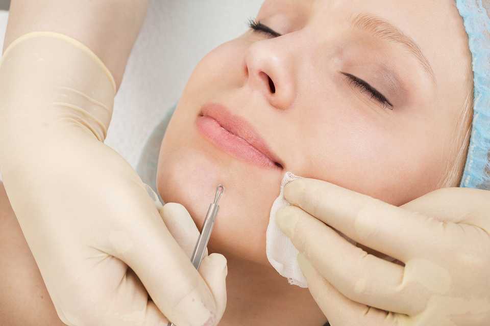 Косметолог проводит процедуру механической чистки лица