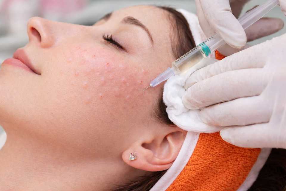 Биоревитализация лица