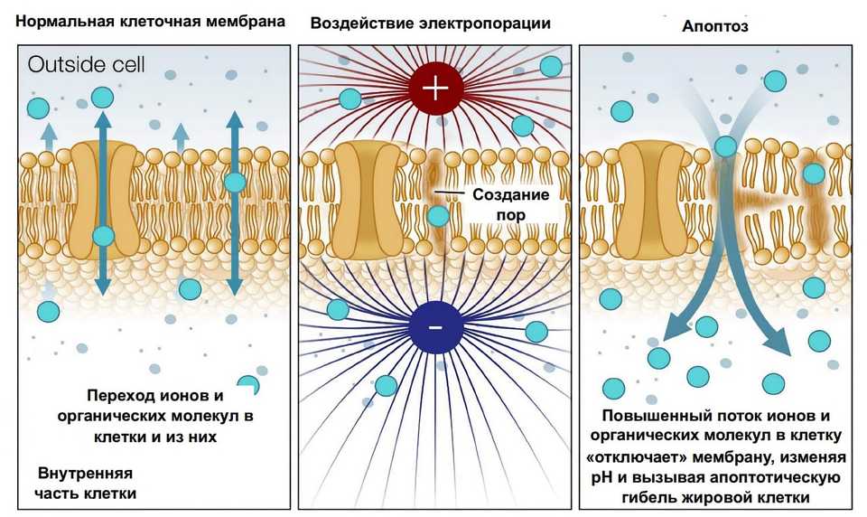 Принцип действия InMode с насадкой Body FX