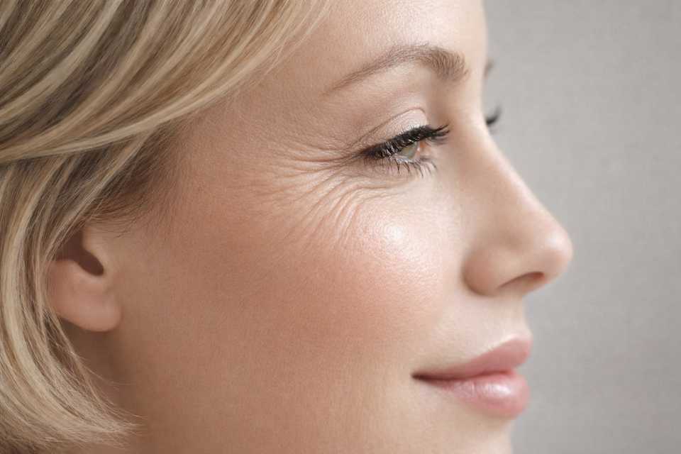 глубокие морщины